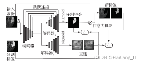 毕业设计-基于深度学习的医学影像分割